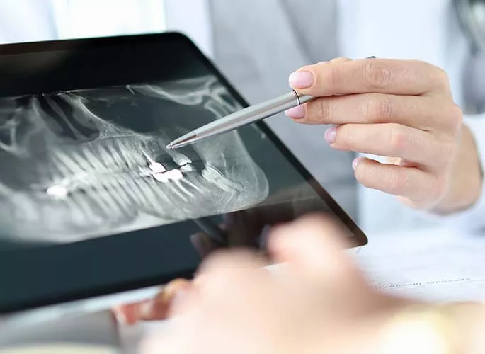 endodontics in markham