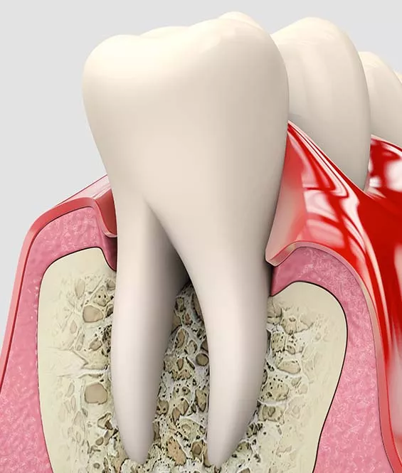 periodontics in markham